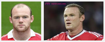 Rooney.png